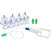 Cupping β カッピング吸引器 美容・エステ器具 セット Cupping β カッピング吸引器 美容・エステ器具 セット Cupping β